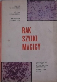 Rak szyjki macicy