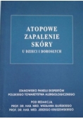 Atopowe zapalenie skóry