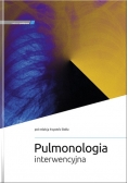 Pulmonologia interwencyjna