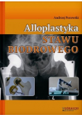 Alloplastyka stawu biodrowego