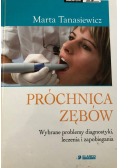 Próchnica zębów wybrane problemy diagnostyki leczenia i zapobiegania