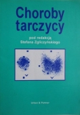 Choroby tarczycy