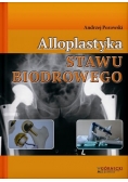 Alloplastyka stawu biodrowego