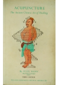 Acupuncture