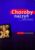 Choroby naczyń