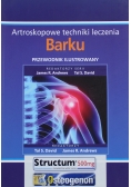 Artroskopowe techniki leczenia barku