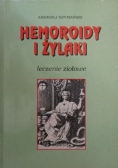 Hemoroidy i żylaki
