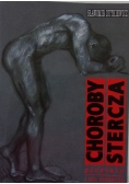 Choroby stercza prostaty i ich leczenie