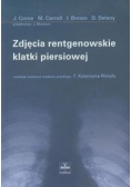Zdjęcia rentgenowskie klatki piersiowej