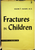 Fractures in children