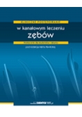 Kliniczne postępowanie w kanałowym leczeniu zębów