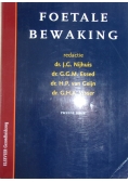 Fortale Bewaking