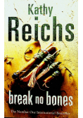 Break no bones