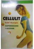 Cellulit, zapobieganie i leczenie