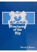 Fractures of the Hip