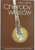 Choroby włosów