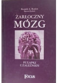 Żarłoczny Mózg Pułapki Uzależnień
