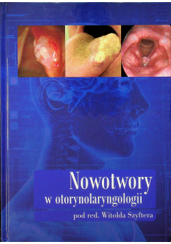 Nowotwory w otorynolaryngologii