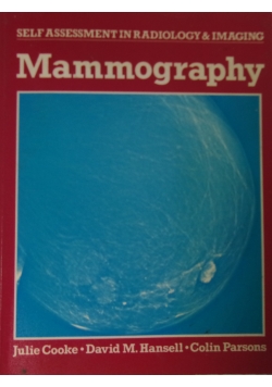 Mammography