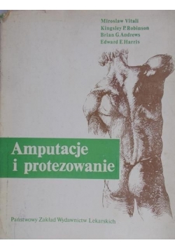 Amputacje i protezowanie
