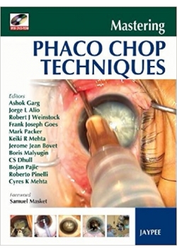 Phaco chop techniques