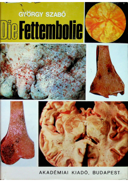 Die Fettembolie