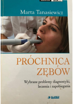 Próchnica zębów wybrane problemy diagnostyki leczenia i zapobiegania