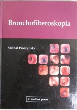 Bronchofiberoskopia