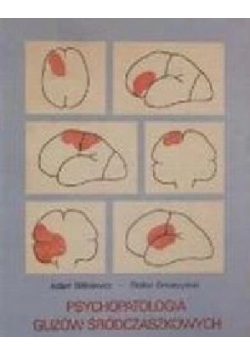 Psychologia Guzów Śródczaszkowych