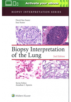 Biopsy Interpretation of the Lung Second edition