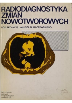 Buraczewski   Janusz  (red.) - Radiodiagnostyka zmian nowotworowych