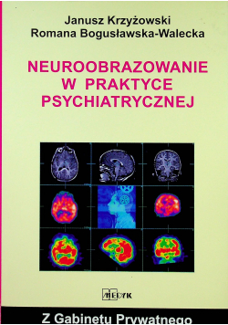 Neuroobrazowanie w praktyce psychiatrycznej