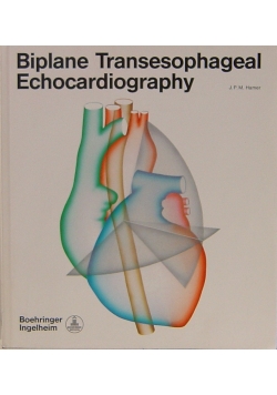 Biplane Transesophageal Echocardiography