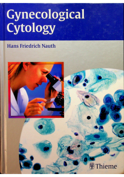 Gynecologic Cytology
