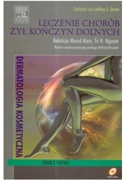 Leczenie chorób żył kończyn dolnych