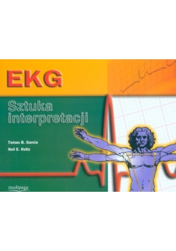 EKG Sztuka interpretacji