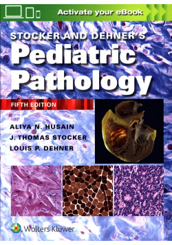 Stocker and Dehner's Pediatric Pathology Fifth edition