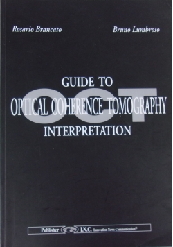 Guide to optical coherence tomography