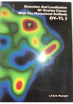 Detection and Localization of Ovarian Cancer with the Monoclonal Antibody