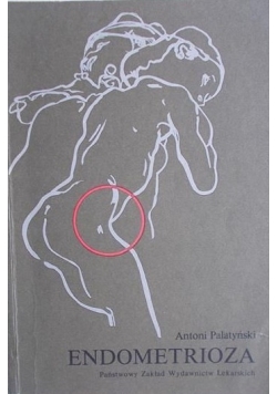 Endometrioza
