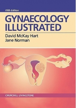 Gynaecology Illustrated