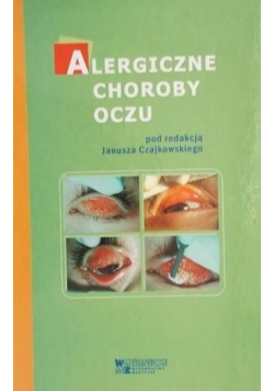 Alergiczne choroby oczu