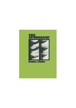 Knee arthrography