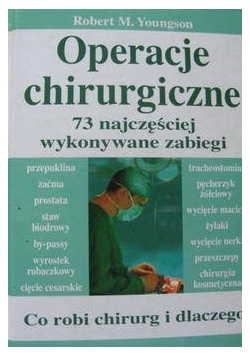 Operacje chirurgiczne 73 najczęściej wykonywane zabiegi