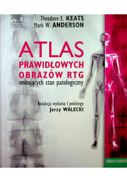 Atlas prawidłowych  obrazów RTG imitujących stan patologiczny