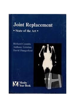 Joint Replacement. State of the art