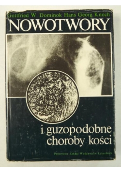 Nowotwory i guzopodobne choroby kości