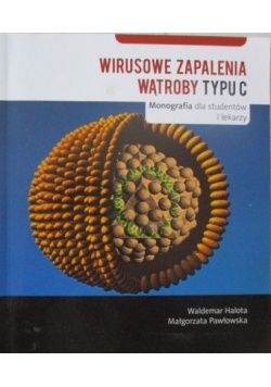 Wirusowe zapalenie wątroby typu C