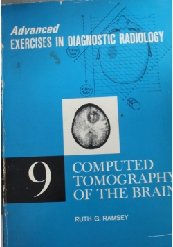 Computed Tomography of the Brain