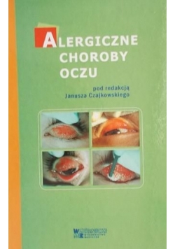 Alergiczne choroby oczu